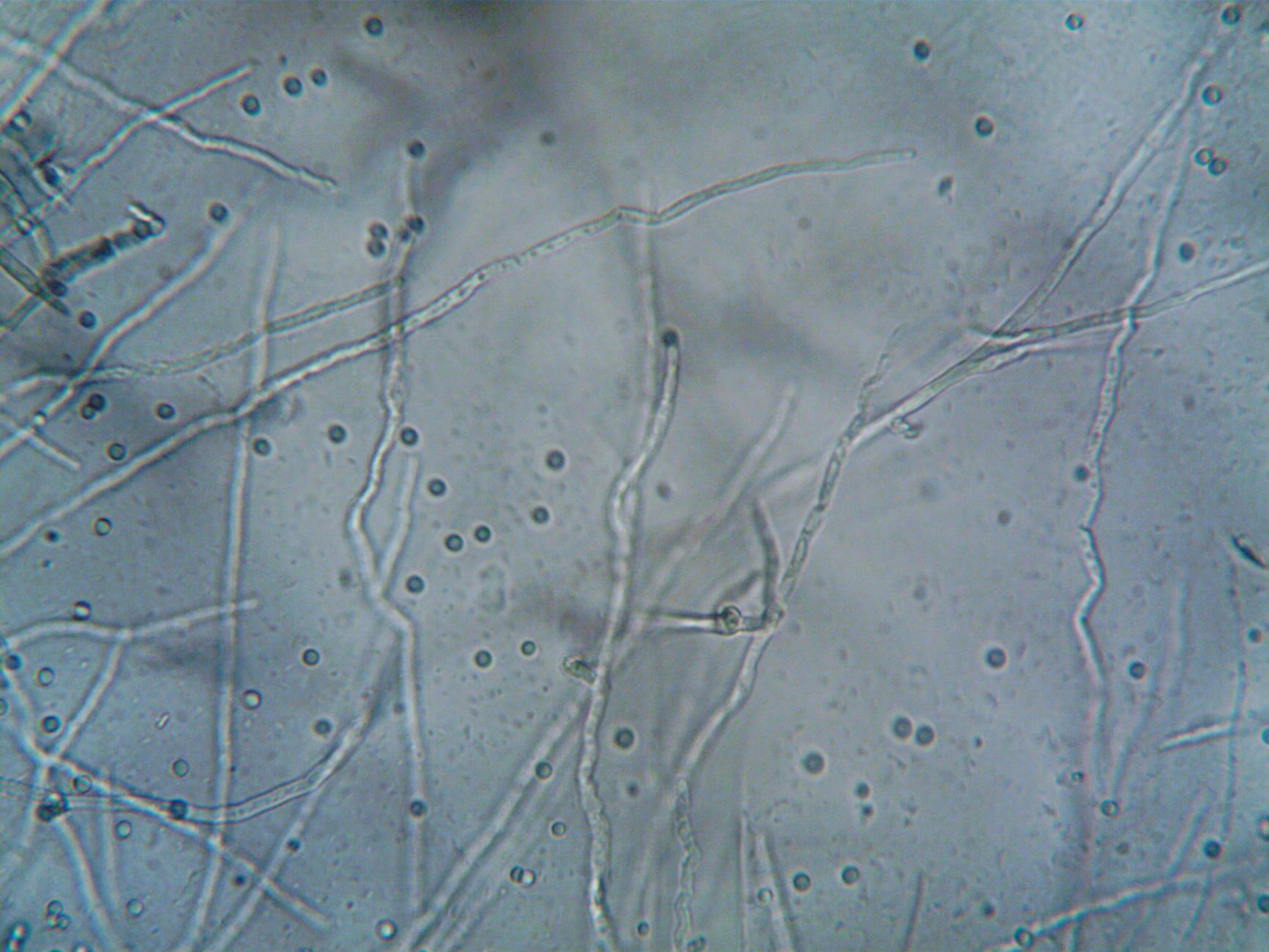 Rust-Breathing Microbes: A Potential Solution to Oceanic Dead Zones